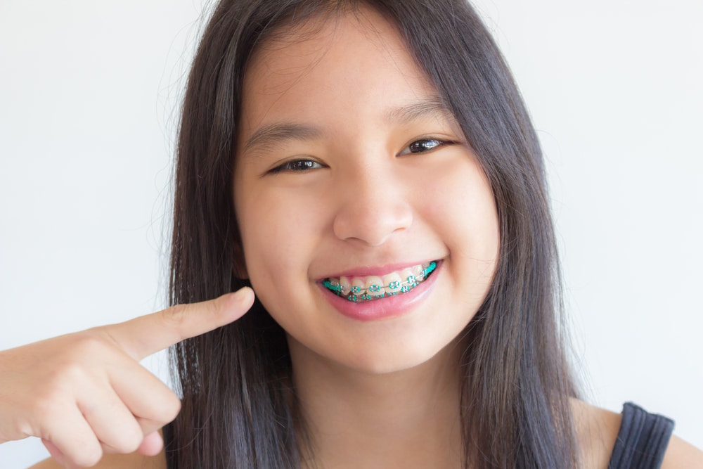 Affordable Braces in Weatherford, TX Wood Orthodontics Weatherford